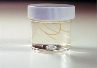 Heart Worm - Dirofilaria