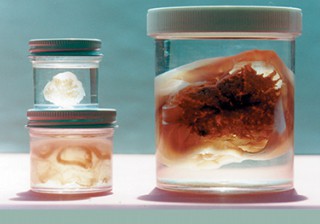 Scyphazoan Survey Set